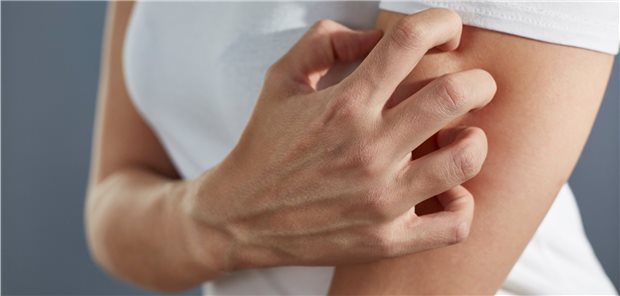 Juckreiz: Bei Patienten mit Cholestase-assoziiertem Pruritus gab es positive Ergebnisse für den Einsatz von Bezafibrat.