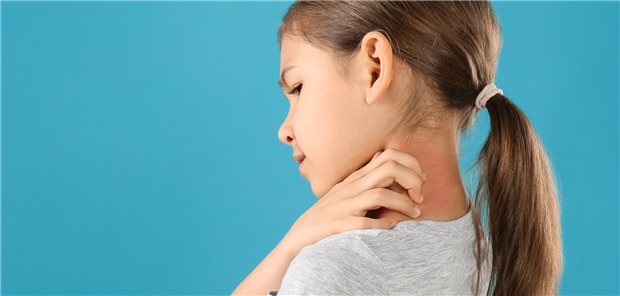 Juckreiz ist eines der belastendsten Symptome bei atopischer Dermatitis.