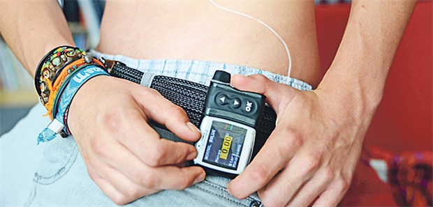 Hohes Sterberisiko bei Ausbruch in der Adoleszenz Jugendlicher mit Insulinpumpe: Bricht Diabetes in einer vulnerablen Lebensphase aus, drohen vielfältige Probleme.