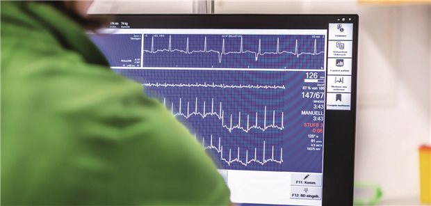 KI-gestütztes EKG