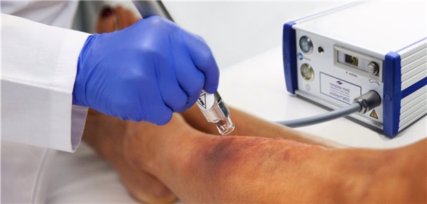 Kaltplasmatherapie in Anwendung: Kommt sie in den GKV-Leistungskatalog? Das wird sich zeigen.