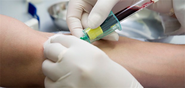 Parkinson zeigt sich im Blut Kann Parkinson künftig über einen Bluttest eindeutig diagnostiziert werden?