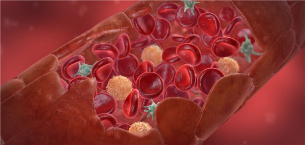 Kapillare mit Erythrozyten und Thrombozyten: Im Alltag erhalten nur etwa 60 Prozent der PAVK-Patienten Thrombozytenfunktionshemmer.&#xA;