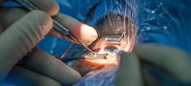 Augen-Op schützt die Hüften Katarakt-Op - lohnt sich auch zur Frakturprophylaxe.