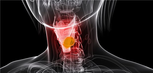 Kehkopfkrebs: Mit einer neuen Op-Methode lässt sich die die schluck- und stimmbezogene Lebensqualität deutlich verbessern.