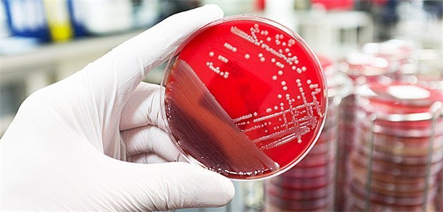 33.000 Tote pro Jahr durch resistente Keime Keime in einer Petrischale: Wegen multiresistenten Erregern gibt es europaweit immer mehr Todesfälle.