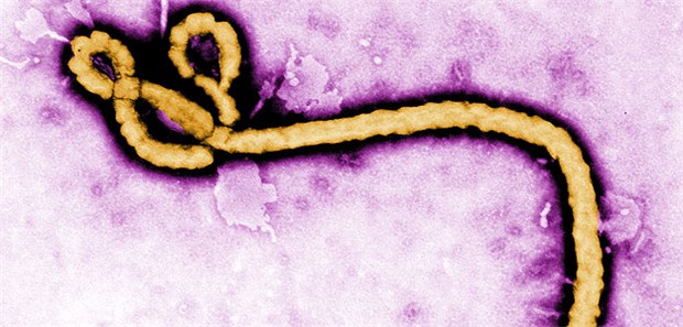 Schlechte Zeiten für Wunderheiler Kein Fall für den Wunderheiler: der Ebola-Erreger.