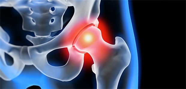 Keine Rarität: Arthrose-typische Beschwerden, aber kein Hinweis darauf im Röntgenbild.