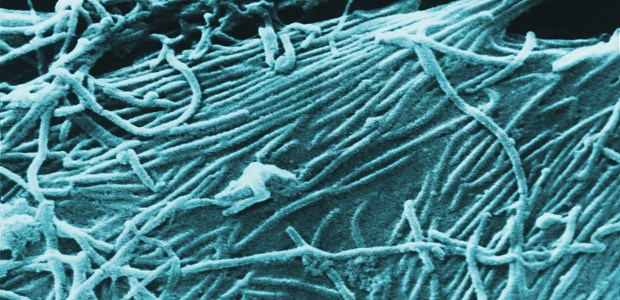 Weitere Todesfälle in Guinea Keine Spaghetti mit Sepiasauce - sondern Ebolaviren.