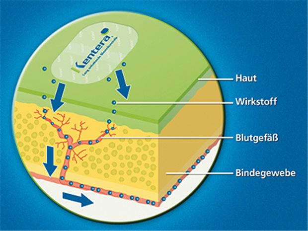 Kentera® ist ein Matrixpflaster mit dem Wirkstoff Oxybutynin. © Merckle Recordati