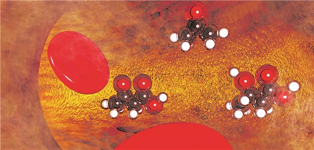Ketonkörper – Vom Feind zum fleißigen Helfer bei der Prävention Ketonkörper im Gefäß: Die Ketone sind Marker für eine Lipolyse.