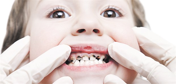 Wachsen zähne lassen selber Studie: Zähne