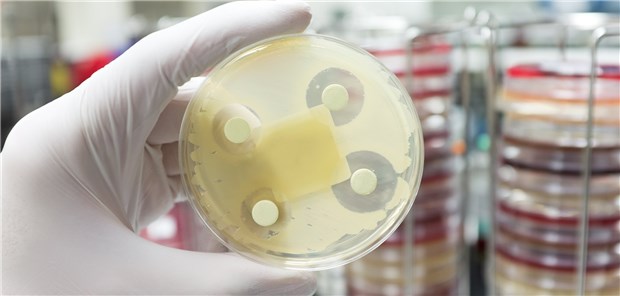 Klassisches Antibiogramm zeigt wirksame Substanzen an.