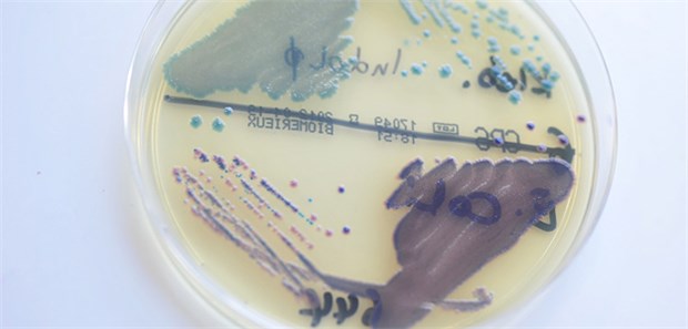 Resistenzen gegen Antibiotika werden bedrohlich Klebsiellen in der Kulturschale. Besonders auch die Carbapenem-resistenten Klebsiellae pneumoniae (CRKP) sind ein bedrohliches Problem.