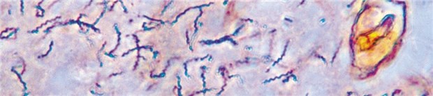 "Heilendes Arsen" gegen Syphilis Kleiner Erreger, verheerende Wirkung: Eine mikroskopische Phasenkontrast-Aufnahme von Syphilis-Erregern im Maßstab 1360:1.