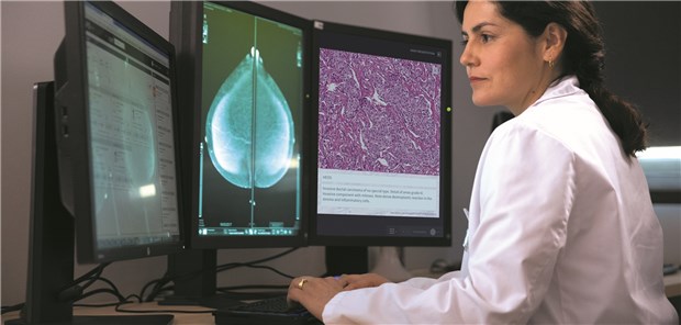 Feilen an der digitalen Krebsmedizin Klinikärztin bei der Vorbereitung einer Tumorkonferenz mit dem Navify-System.