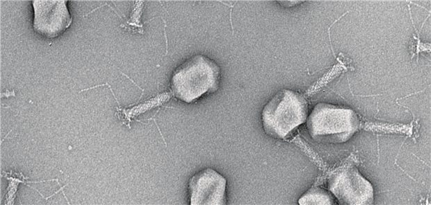 Klinische Daten sind spärlich: EM-Aufnahme von Phagen.