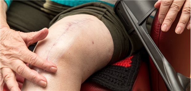 Knie-TEP: Adipositas ist kein Hinderungsgrund.