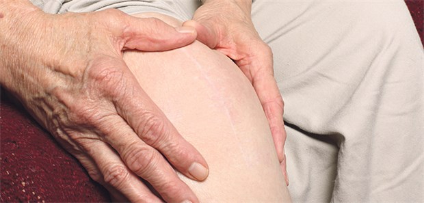 Einlage sorgt für Entlastung Kniearthrose, das Gelenk schmerzt: Orthopädische Hilfsmittel können Linderung bringen.