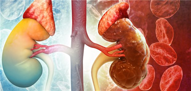 Körperliche Aktivität schützt die Nierenfunktion bei übergewichtigen Patienten mit Typ-2-Diabetes anscheinend auch langfristig.