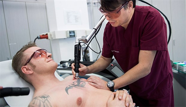 Die rechtliche Grauzone rund ums Tattoo weglasern Körperschmuck, der nicht mehr gern gesehen ist: Dr. Klaus Hoffmann von der Uniklinik in Bochumlasert etwa zehn bis 15 Patienten täglich ihre Tattoos weg.