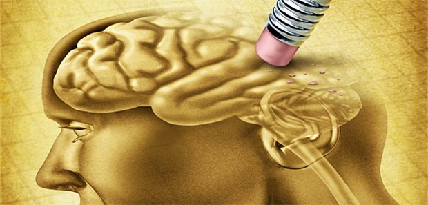 Mögliche Alzheimer-Bremse Kognitiver Abbau: BDNF scheint die Beta-Amyloid-Synthese im Gehirn bei Morbus Alzheimer zu bremsen.