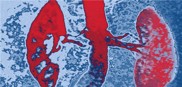 Kolorierte MRT-Aufnahme der Nieren: Eine vielversprechende neue Therapie für Patienten mit Niereninsuffizienz zeichnet sich ab.