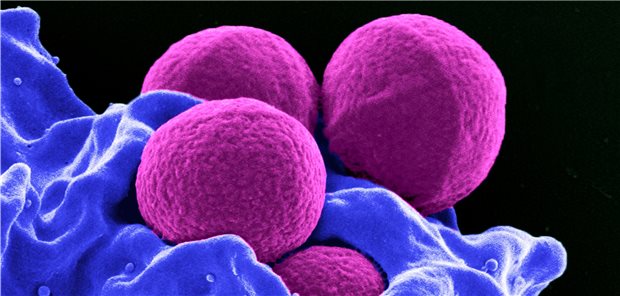 Kolorierte SEM-Aufnahme von MRSA-Bakterien (lila), die von einem neutrophilen Granulozyten (blau) phagozytiert werden.