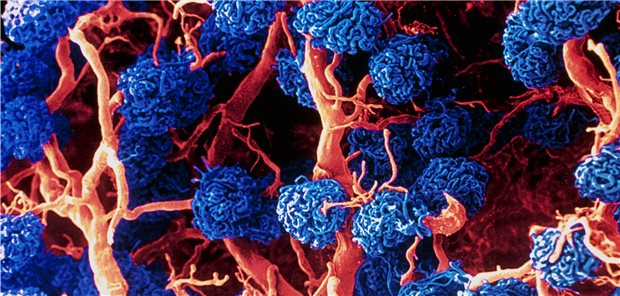 Kolorierte SEM-Aufnahme von Nierenglomeruli (blau) und Blutgefäßen (orange) in einer menschlichen Niere.