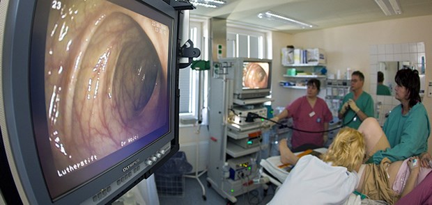 Darmkrebs seltener in Kliniken Koloskopie: Die Zahl der Darmkrebsfälle in Deutschlands Kliniken ist gesunken.