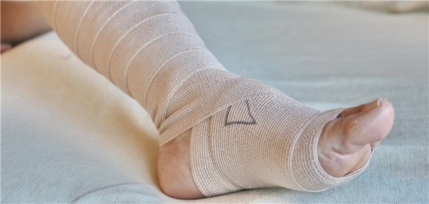 Ein einbandagierter Fuß