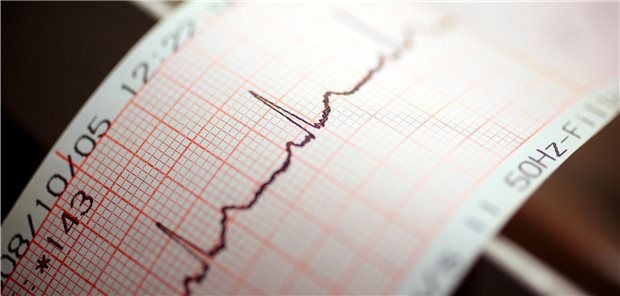 Kontroll-EKG. Kann es bei Sarkoidose-Patienten dazu beitragen, kardiale Zwischenfälle zu verhindern?