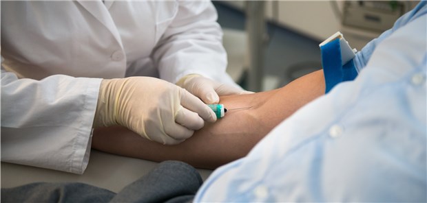 Kontrolle der Cholesterinwerte: Welche Folgen hat ein niedriger Spiegel? 