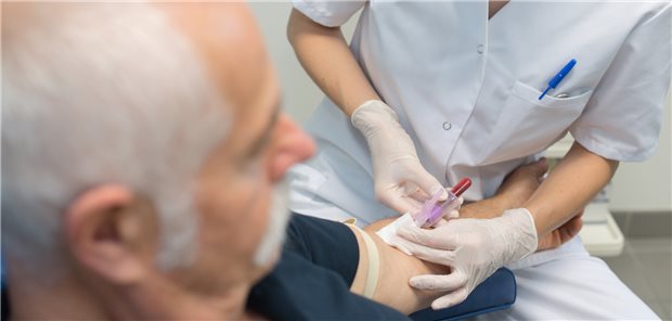 Kontrolle der Testosteronwerte. Bisweilen können die Ergebnisse den Verdacht auf eine Opioid-induzierte Androgendefizienz stützen. (Symbolbild mit Fotomodellen)
