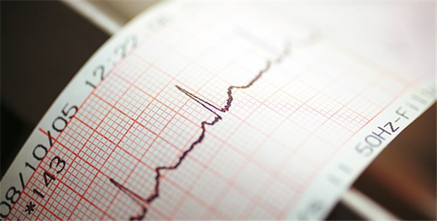 Tipps für die praktische Therapie von Patienten mit Vorhofflimmern Kontrolle des Herzschlags mit einem EKG.