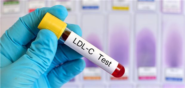 Kontrolle des LDL-Cholesterins: Wichtig ist es, die Patienten über die Bedeutung des LDL-Cholesterins aufzuklären und zu schulen.