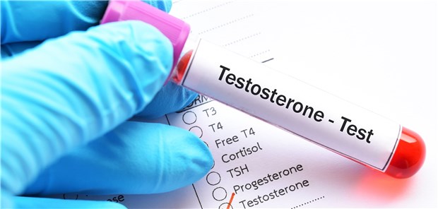 Kontrolle des Testosteronspiegels. Testosteronpräparate werden wohl immer noch auch Männern verschrieben, bei denen im Labor kein Hypogonadismus nachgewiesen wurde. 