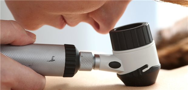 Kontrolle einer Hautveränderung: Bei Teilnehmern einer Studie, die Melanome und kutane Metastasen hatten, waren diese oft an den unteren Extremitäten zu finden.