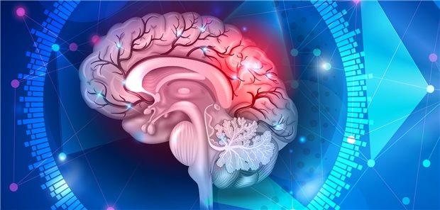 Kopfschmerzen: Mit Eptinezumab ist für die Prophylaxe von Migräne eine neue Option zugelassen.