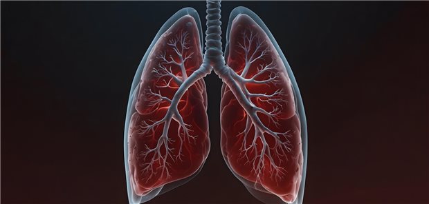 Illustration einer entzündeten Lunge.