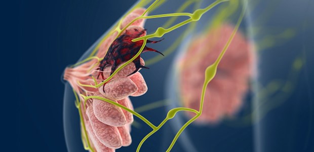 Brustkrebs: So manche Maßnahme könnte man den Patientinnen ersparen Kranke Brust.