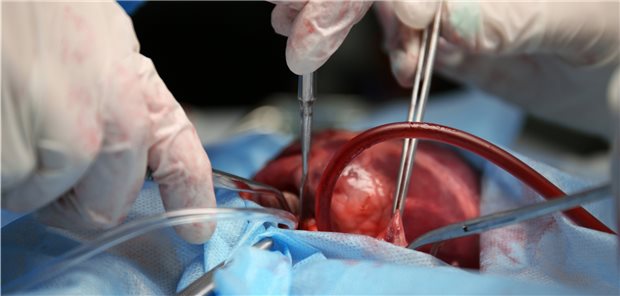 Operation am offenen Herzen