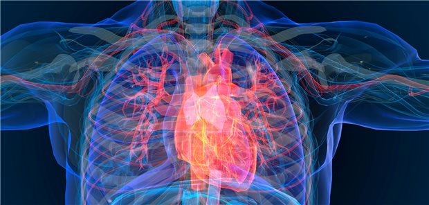 Krankes Herz im Modell: Bei vielen Patienten mit Herzinsuffizienz kommt es zu einer Abwärtsspirale, die schließlich zum Tod führt.