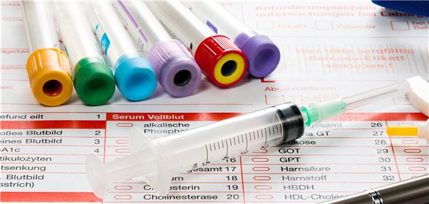Kreatinin gehört zu den Standard-Laborwerten zur Überprüfung der Nierenfunktion. Auf dem Anforderungsblatt ist allerdings in der Regel nicht vermerkt, nach welcher Methode gemessen werden soll.