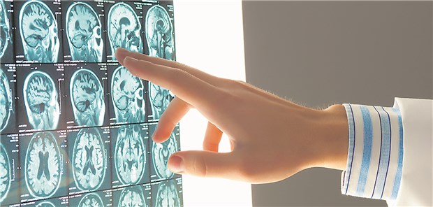 Krebs-Bildgebung: Statt nur Therapieplanung mit MRT-Bildern künftig „Live“-Verfolgung der Bestrahlung?