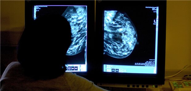 Radiologen warnen vor langen Wartezeiten Krebs? Ein Verdacht erfordert schnelles Handeln, Radiologen befürchten jedoch lange Wartezeiten