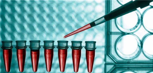 Krebs auf der Spur: Für einen Bluttest haben Forscher nach spezifischen Tumorsignalen in zellfreier DNA gesucht, etwa Mutationen oder Methylierungsvarianten.