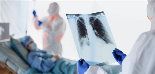 COVID-19 und Krebs: völlig neue Fragestellungen Krebskrank und gleichzeitig an COVID-19 erkrankt? Onkologen sammeln jetzt Daten, um Betroffene in dieser Situation optimal behandeln zu können.