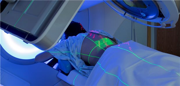 Krebspatientin erhält Radiatio: Bei der Strahlentherapie gilt mittlerweile „Weniger ist mehr“. Möglich wird das dank neuer Bestrahlungs- und bildgebender Technologien.
