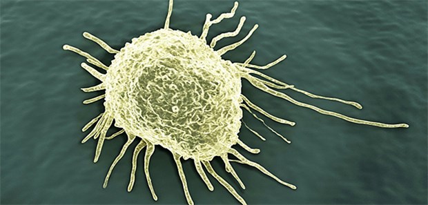 Tumor ist nicht gleich Tumor – Ist auch jede Metastase anders? Krebszelle: Der Primärtumor besteht oft aus vielen verschiedenen genetischen Subklonen. Diese können auch eine unterschiedliche "Neigung" zur Metastasierung besitzen.
